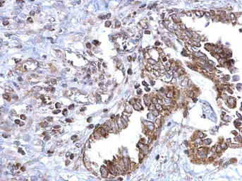 Anti-SDHB antibody used in IHC (Paraffin sections) (IHC-P). GTX113833