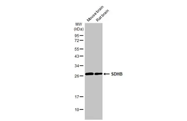 Anti-SDHB antibody used in Western Blot (WB). GTX113833