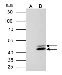 Anti-SET antibody used in Immunoprecipitation (IP). GTX113834