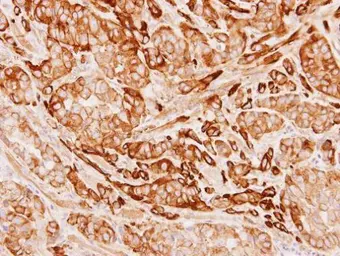 Anti-Tropomyosin 1 antibody used in IHC (Paraffin sections) (IHC-P). GTX113857