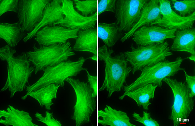 Anti-Tropomyosin 1 antibody used in Immunocytochemistry/ Immunofluorescence (ICC/IF). GTX113857