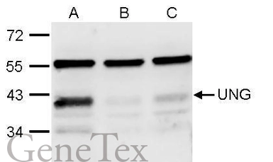 Anti-UNG antibody used in Western Blot (WB). GTX113860