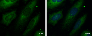 Anti-UNG antibody used in Immunocytochemistry/ Immunofluorescence (ICC/IF). GTX113860