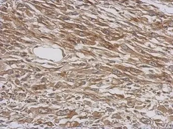 Anti-Tryptophanyl tRNA synthetase antibody used in IHC (Paraffin sections) (IHC-P). GTX113861