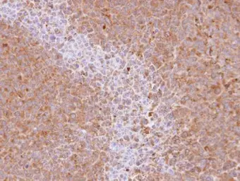 Anti-SRC3 antibody [N1N2], N-term used in IHC (Paraffin sections) (IHC-P). GTX113869