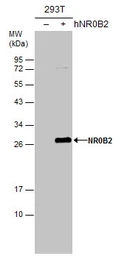 Anti-NR0B2 antibody [N2C3] used in Western Blot (WB). GTX113874