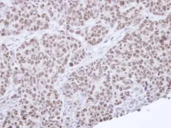 Anti-NR0B2 antibody [N2C3] used in IHC (Paraffin sections) (IHC-P). GTX113874