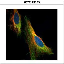 Anti-NOL3 antibody used in Immunocytochemistry/ Immunofluorescence (ICC/IF). GTX113889
