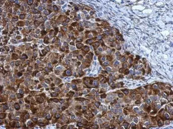 Anti-NOL3 antibody used in IHC (Paraffin sections) (IHC-P). GTX113889