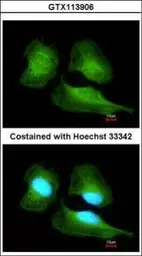 Anti-Cullin 7 antibody [C2C3], C-term used in Immunocytochemistry/ Immunofluorescence (ICC/IF). GTX113906