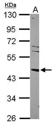Anti-LXR alpha antibody [N1C2] used in Western Blot (WB). GTX113912