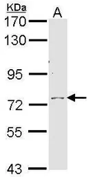 Anti-Calpain 10 antibody [N1C1] used in Western Blot (WB). GTX113929