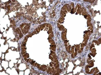 Anti-Calcium binding protein p22 antibody used in IHC (Paraffin sections) (IHC-P). GTX113936