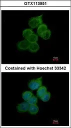 Anti-BACE2 antibody [C1C3] used in Immunocytochemistry/ Immunofluorescence (ICC/IF). GTX113951