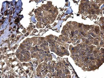 Anti-BACE2 antibody [C1C3] used in IHC (Paraffin sections) (IHC-P). GTX113951