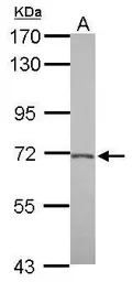 Anti-BACE2 antibody [C1C3] used in Western Blot (WB). GTX113951