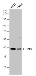 Anti-PBK antibody [N2C3] used in Western Blot (WB). GTX113982