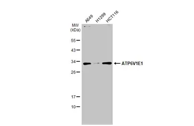 Anti-ATP6V1E1 antibody used in Western Blot (WB). GTX114056