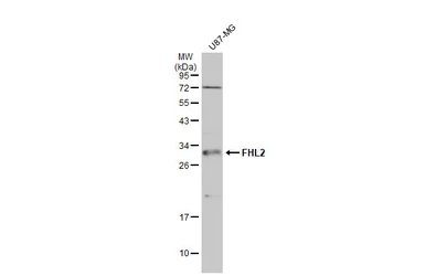 Anti-FHL2 antibody used in Western Blot (WB). GTX114072
