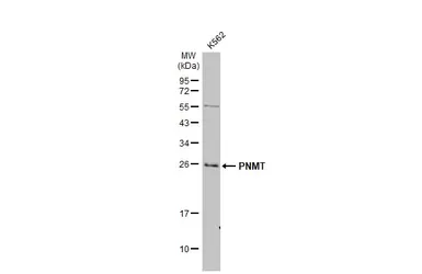 Anti-PNMT antibody [N2C3] used in Western Blot (WB). GTX114098