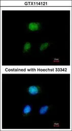 Anti-HEYL antibody [N1C1] used in Immunocytochemistry/ Immunofluorescence (ICC/IF). GTX114121