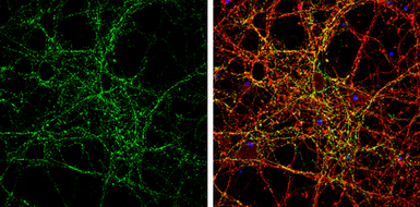 Anti-Synaptotagmin 1 antibody [N1C2] used in Immunocytochemistry/ Immunofluorescence (ICC/IF). GTX114124