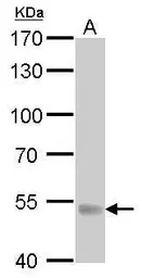 Anti-UGT1A antibody used in Western Blot (WB). GTX114131
