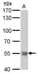 Anti-UGT1A antibody used in Western Blot (WB). GTX114131