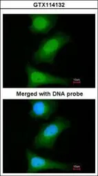 Anti-Livin antibody used in Immunocytochemistry/ Immunofluorescence (ICC/IF). GTX114132