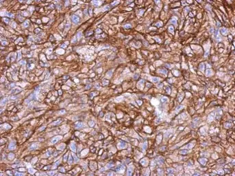 Anti-HLA-B antibody used in IHC (Paraffin sections) (IHC-P). GTX114151