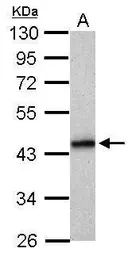 Anti-HLA-B antibody used in Western Blot (WB). GTX114151