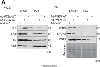 Anti-Renin Receptor antibody [N3C3] used in Western Blot (WB). GTX114169