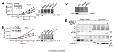 Anti-Renin Receptor antibody [N3C3] used in Western Blot (WB). GTX114169