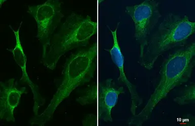 Anti-Renin Receptor antibody [N3C3] used in Immunocytochemistry/ Immunofluorescence (ICC/IF). GTX114169
