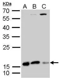 Anti-Destrin antibody used in Western Blot (WB). GTX114170