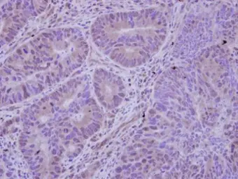 Anti-HDAC7 antibody [C2C3], C-term used in IHC (Paraffin sections) (IHC-P). GTX114179