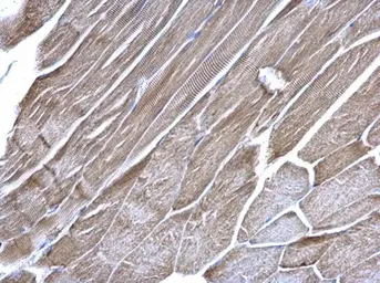 Anti-VDAC1 antibody [N1C2] used in IHC (Paraffin sections) (IHC-P). GTX114187