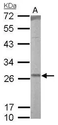 Anti-RALA antibody used in Western Blot (WB). GTX114204