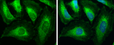 Anti-ACAA1 antibody used in Immunocytochemistry/ Immunofluorescence (ICC/IF). GTX114229