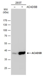 Anti-ACADSB antibody used in Western Blot (WB). GTX114231