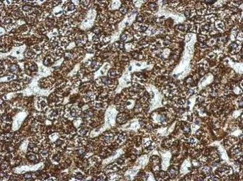Anti-ACADSB antibody used in IHC (Paraffin sections) (IHC-P). GTX114231
