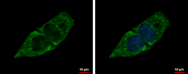 Anti-ACADSB antibody used in Immunocytochemistry/ Immunofluorescence (ICC/IF). GTX114231