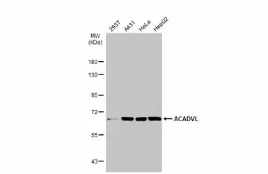 Anti-ACADVL antibody [N1C1] used in Western Blot (WB). GTX114232