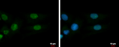 Anti-ADAR2 antibody used in Immunocytochemistry/ Immunofluorescence (ICC/IF). GTX114237