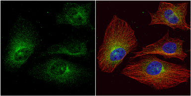 Anti-ALPPL2 antibody used in Immunocytochemistry/ Immunofluorescence (ICC/IF). GTX114250
