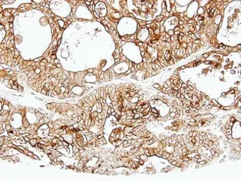 Anti-ALPPL2 antibody used in IHC (Paraffin sections) (IHC-P). GTX114250
