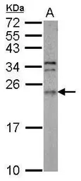 Anti-ARL3 antibody [N1C3] used in Western Blot (WB). GTX114264