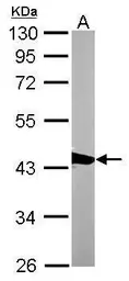 Anti-CAPG antibody [N3C3] used in Western Blot (WB). GTX114301