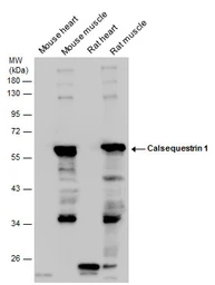 Anti-Calsequestrin 1 antibody used in Western Blot (WB). GTX114304