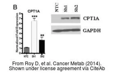 Anti-CPT1A antibody [C1C2], Internal used in Western Blot (WB). GTX114337